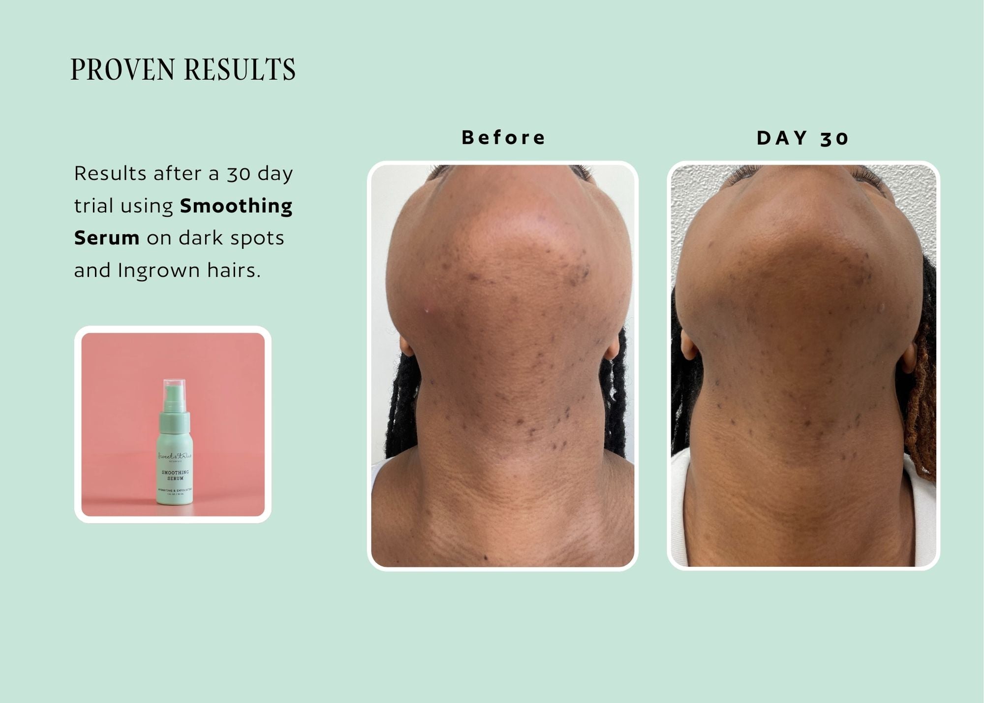 Smoothing Ingrown Hair Serum Back Bar (4oz)